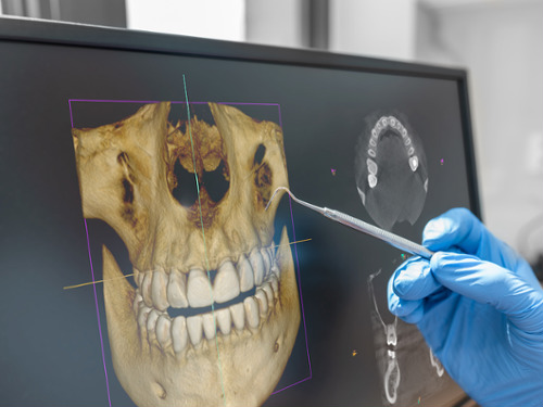 3-D Cone Beam Imaging (CBCT)