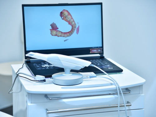 Intraoral Camera