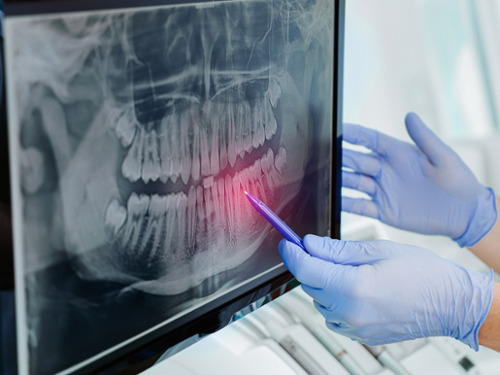 Digital X-Rays